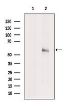 SPTLC1 Antibody in Western Blot (WB)