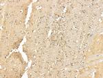 SSX2IP Antibody in Immunohistochemistry (Paraffin) (IHC (P))