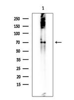 SPAK Antibody in Western Blot (WB)