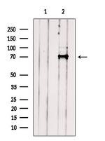 STS1 Antibody in Western Blot (WB)