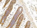 SULF1 Antibody in Immunohistochemistry (Paraffin) (IHC (P))