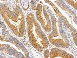 SULF1 Antibody in Immunohistochemistry (Paraffin) (IHC (P))