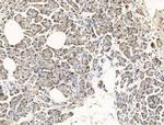 SFTPA2 Antibody in Immunohistochemistry (Paraffin) (IHC (P))