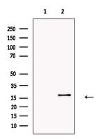 SFTPA2 Antibody in Western Blot (WB)