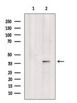 SFTPD Antibody in Western Blot (WB)