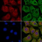 Synaptojanin 1 Antibody in Immunocytochemistry (ICC/IF)