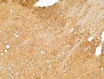 Synaptojanin 1 Antibody in Immunohistochemistry (Paraffin) (IHC (P))