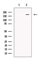 Synaptojanin 1 Antibody in Western Blot (WB)