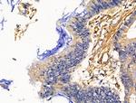 PLS3 Antibody in Immunohistochemistry (Paraffin) (IHC (P))