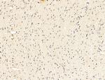 TACC2 Antibody in Immunohistochemistry (Paraffin) (IHC (P))