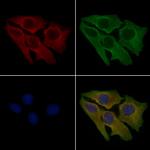 JIK Antibody in Immunocytochemistry (ICC/IF)