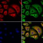 TAP1 Antibody in Immunocytochemistry (ICC/IF)