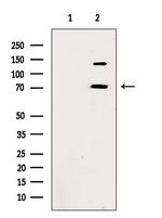 TBLR1 Antibody in Western Blot (WB)