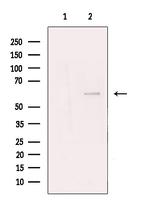 TBLR1 Antibody in Western Blot (WB)