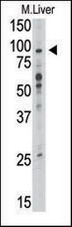 TLR6 Antibody in Western Blot (WB)