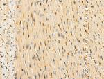 TCF7 Antibody in Immunohistochemistry (Paraffin) (IHC (P))