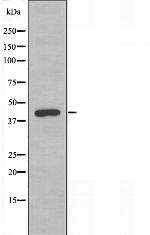 TCF7 Antibody in Western Blot (WB)