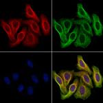 TCP-1 beta Antibody in Immunocytochemistry (ICC/IF)