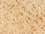 TCP-1 beta Antibody in Immunohistochemistry (Paraffin) (IHC (P))