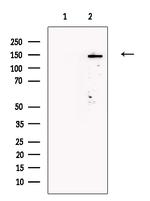 TNN Antibody in Western Blot (WB)