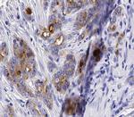 TERT Antibody in Immunohistochemistry (Paraffin) (IHC (P))