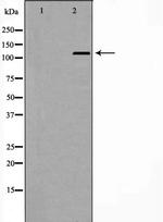 TERT Antibody in Western Blot (WB)