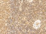 TFAP4 Antibody in Immunohistochemistry (Paraffin) (IHC (P))