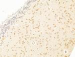 TFAP4 Antibody in Immunohistochemistry (Paraffin) (IHC (P))