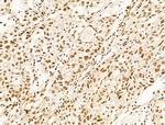 TFAP4 Antibody in Immunohistochemistry (Paraffin) (IHC (P))