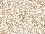 TFAP4 Antibody in Immunohistochemistry (Paraffin) (IHC (P))