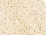 TFAP4 Antibody in Immunohistochemistry (Paraffin) (IHC (P))