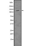 CD202b (TIE2) Antibody in Western Blot (WB)