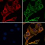 CD202b (TIE2) Antibody in Immunocytochemistry (ICC/IF)