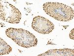 TIM-4 Antibody in Immunohistochemistry (Paraffin) (IHC (P))