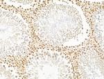 TIM-4 Antibody in Immunohistochemistry (Paraffin) (IHC (P))