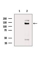 TIMELESS Antibody in Western Blot (WB)