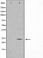 TIMP3 Antibody in Western Blot (WB)