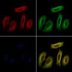 TNF beta Antibody in Immunocytochemistry (ICC/IF)