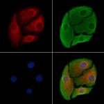 5T4 Antibody in Immunocytochemistry (ICC/IF)