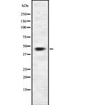 5T4 Antibody in Western Blot (WB)