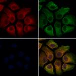 TREM2 Antibody in Immunocytochemistry (ICC/IF)