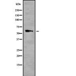 TRF2 Antibody in Western Blot (WB)