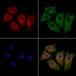 TCHH Antibody in Immunocytochemistry (ICC/IF)