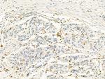 ZFP36 Antibody in Immunohistochemistry (Paraffin) (IHC (P))