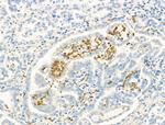 ZFP36 Antibody in Immunohistochemistry (Paraffin) (IHC (P))