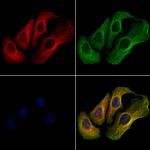 TRPC3 Antibody in Immunocytochemistry (ICC/IF)