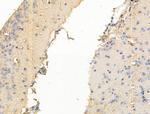 TRPC3 Antibody in Immunohistochemistry (Paraffin) (IHC (P))