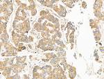 TRPC3 Antibody in Immunohistochemistry (Paraffin) (IHC (P))