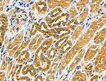 TSC1 Antibody in Immunohistochemistry (Paraffin) (IHC (P))