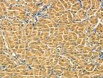 TSC1 Antibody in Immunohistochemistry (Paraffin) (IHC (P))